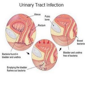 Symptoms of low testerone in women